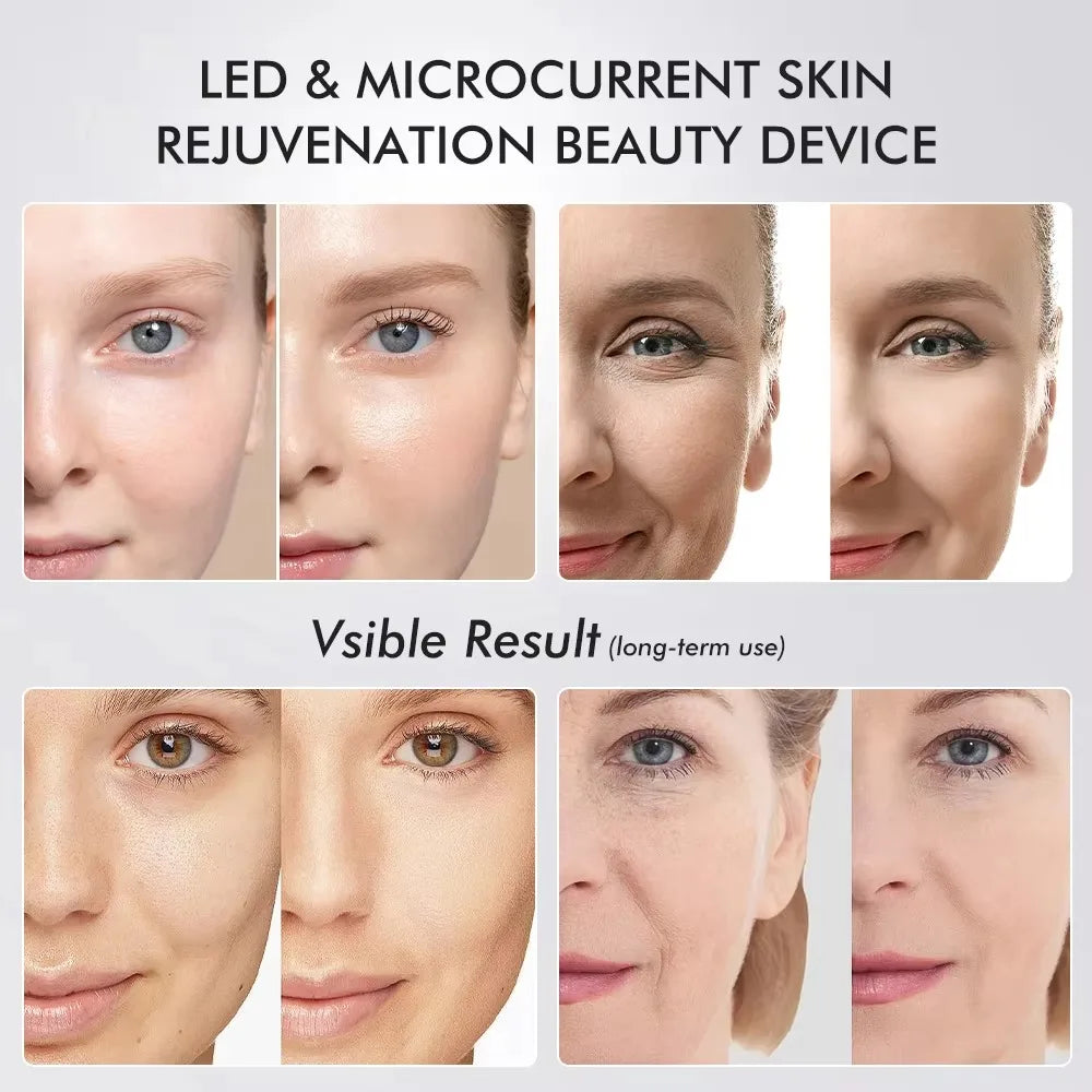 Varita Facial LED 6 en 1 – Terapia de Piel y Rejuvenecimiento